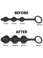 NOXXX Bubb Şişirilebilir Anal Beads - Görsel 6